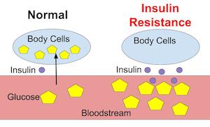 insulin_resistance